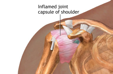 Shoulder deals injury symptoms